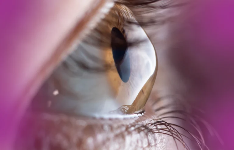 Junho Violeta - Médicos de Olhos S.A.
