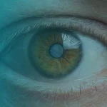 Tratamento de Glaucoma com Laser