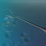 Lente Intraocular