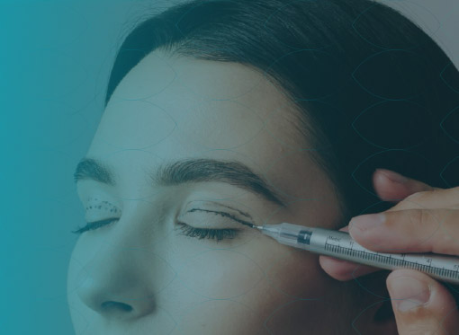 Leia mais sobre o artigo Dermatocalaze e Ptose Palpebral