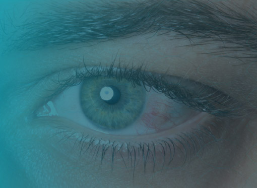 Leia mais sobre o artigo Extensão de Cílios e Lentes de Contato