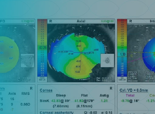 Leia mais sobre o artigo Tamanho da Pupila e Aberrometria