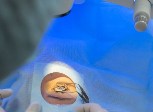 Leia mais sobre o artigo Cirurgia refrativa em Curitiba: como é o dia do paciente