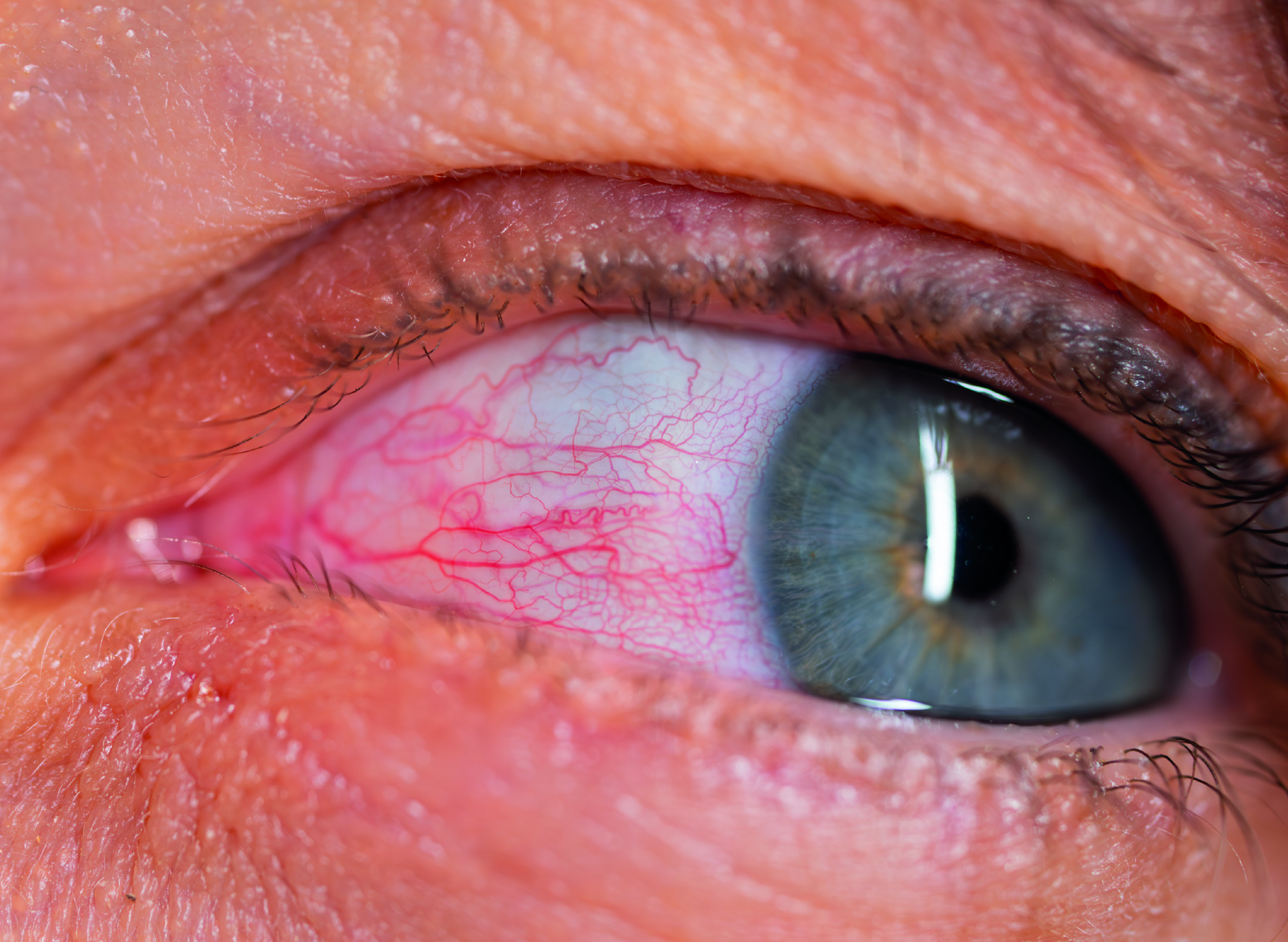 Leia mais sobre o artigo Tudo sobre Ceratite