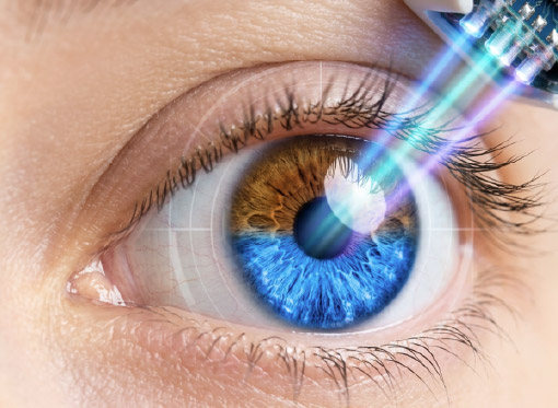 Leia mais sobre o artigo Cirurgia para mudar a cor dos olhos: entenda os riscos e o que dizem os oftalmologistas